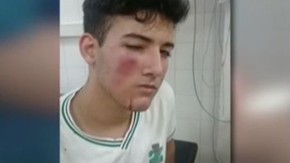 Alumno víctima del ataque Alumno víctima del ataque