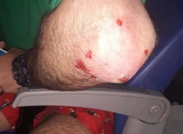 Heridas que dejo la paliza