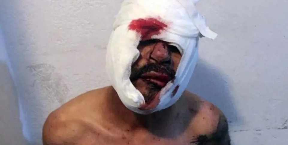Así quedó el abusador Así quedó el abusador