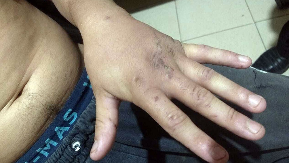 Antecedentes psiquiátricos tiene el individuo