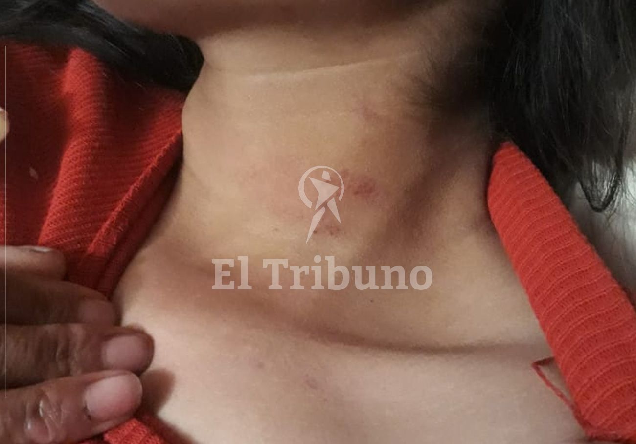 Las lesiones de ahorcadura en el cuello.