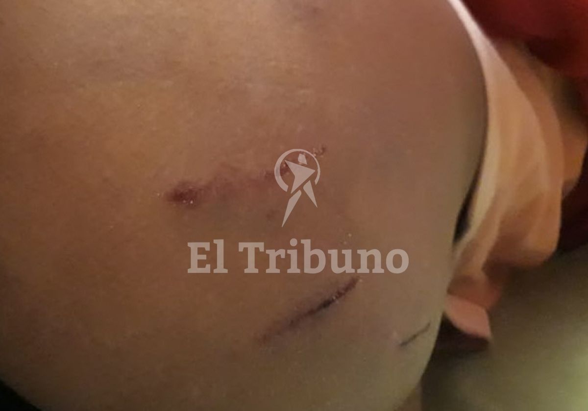 Las improntas de las fauces de los perros en los glúteos.