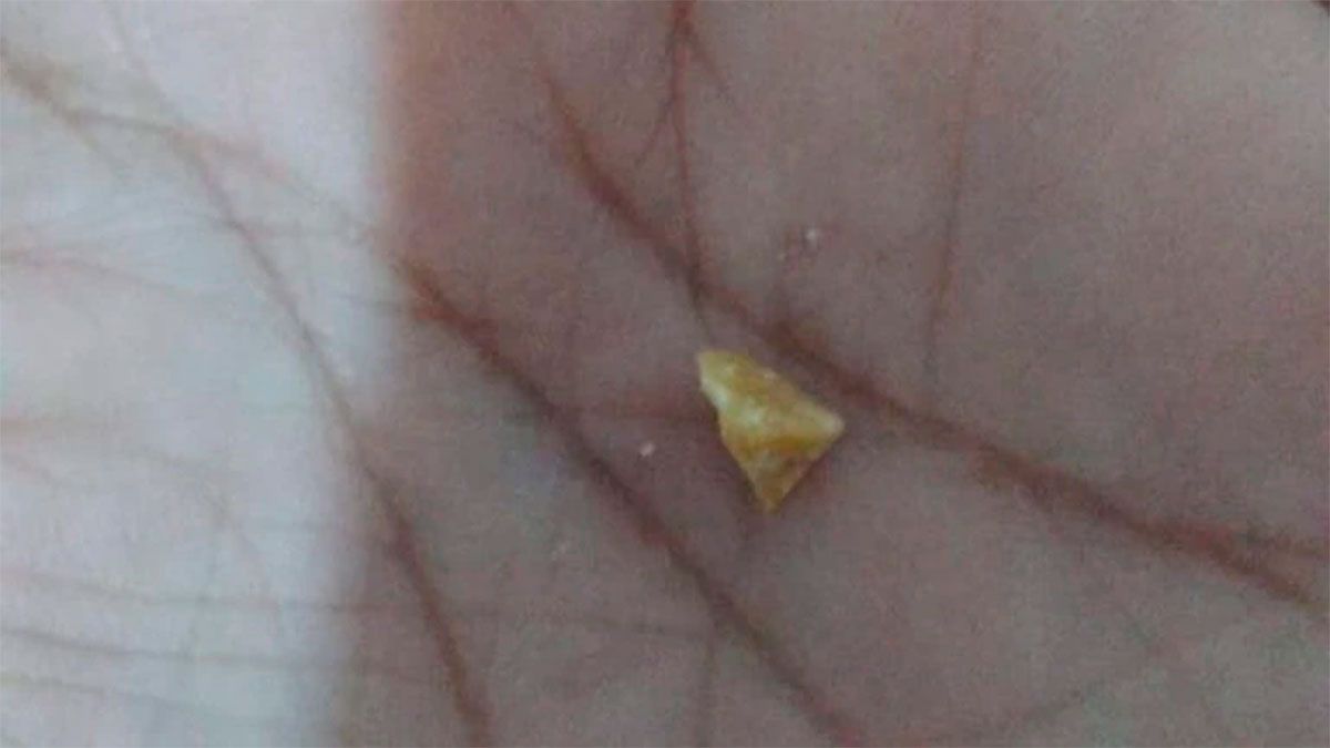 Así es Pedra