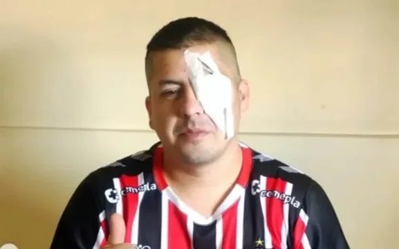 Así quedó Jonathan Navarro tras la represión policial en el Congreso. Así quedó Jonathan Navarro tras la represión policial en el Congreso.