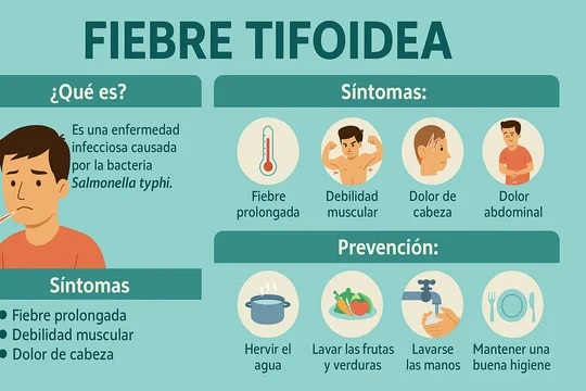 Fiebre tifoidea (NA) Fiebre tifoidea (NA)