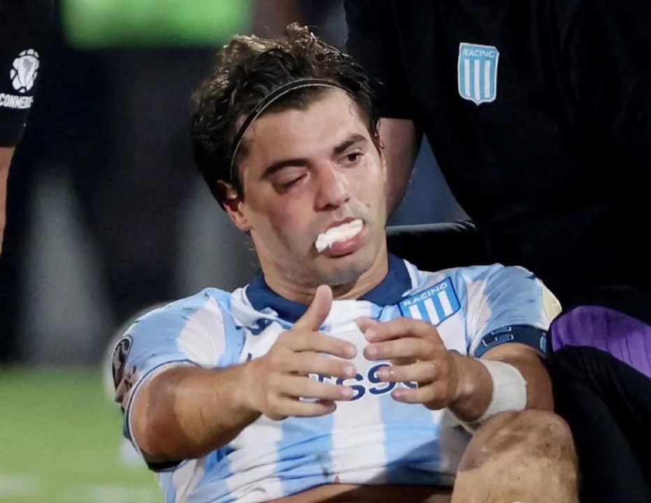 Así quedó Sosa luego del codazo de Rojo. Así quedó Sosa luego del codazo de Rojo.