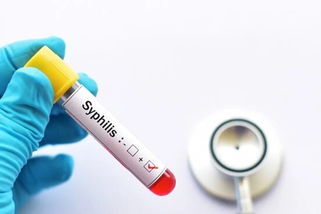 La sífilis es un enfermedad de transmisión sexual.