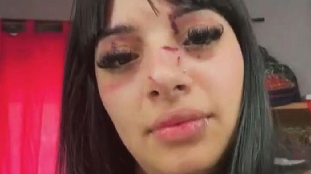 Fue brutalmente atacada a la salida de un boliche en Buenos Aires tras ser reconocida por sus videos de TikTok