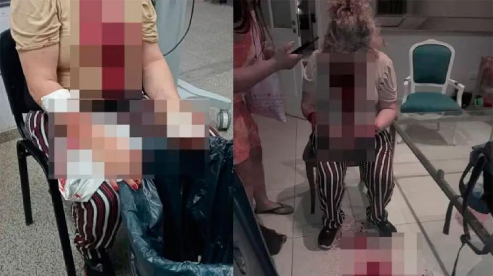 Brutal intento de femicidio: un hombre atacó a su expareja y quiso degollarla