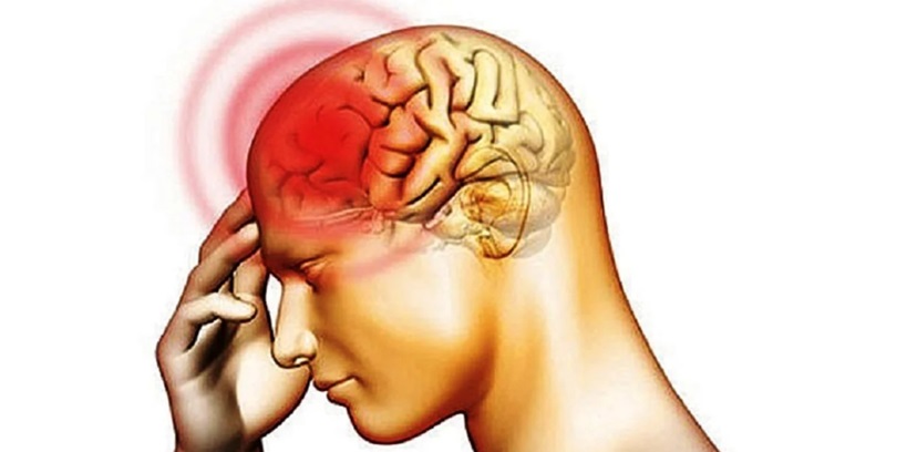 La meningitis bacteriana es una enfermedad grave.