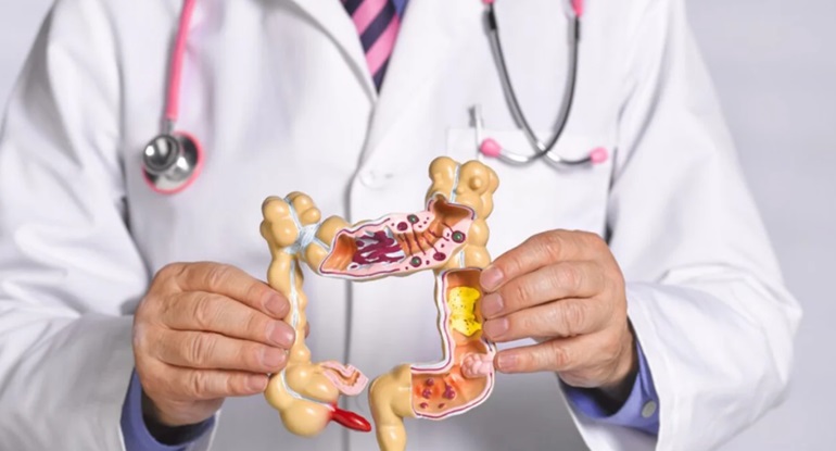 El cáncer de colon puede prevenirse y detectarse a tiempo.
